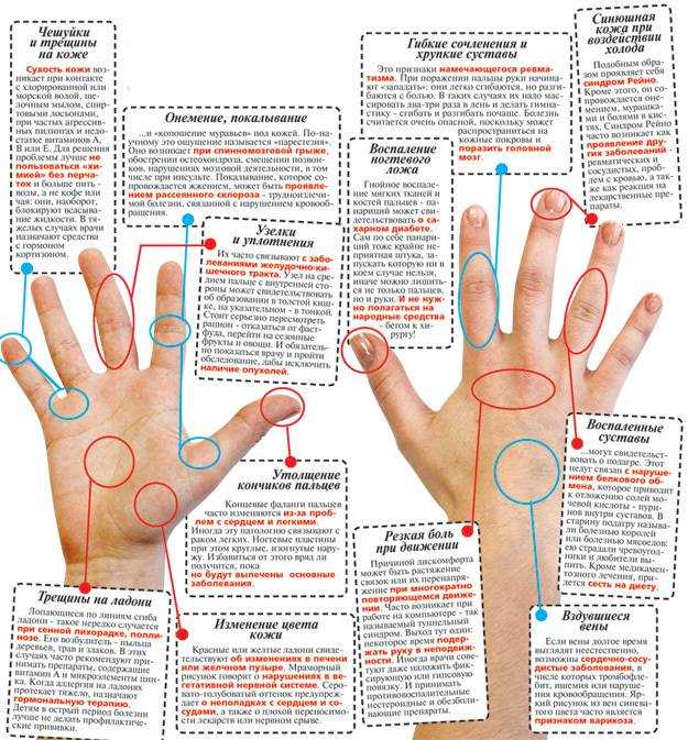 Порезать большой, указательный, средний палец левой или правой руки – примета для девушки