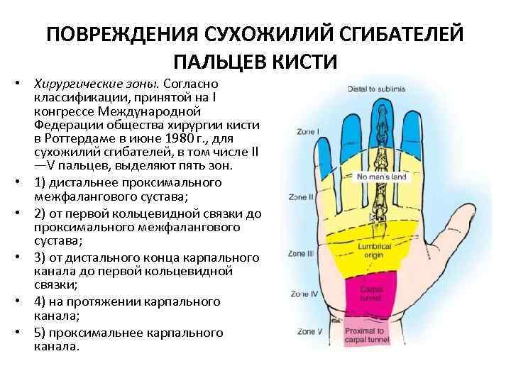К чему порезать палец или руку — приметы и их значение