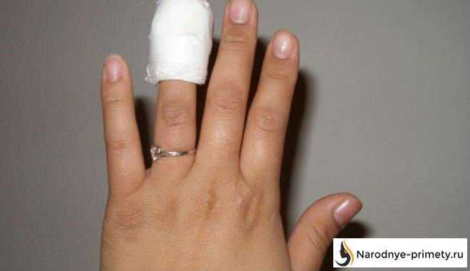Порезать палец — примета для влюбленных и не только, как избавиться от последствий