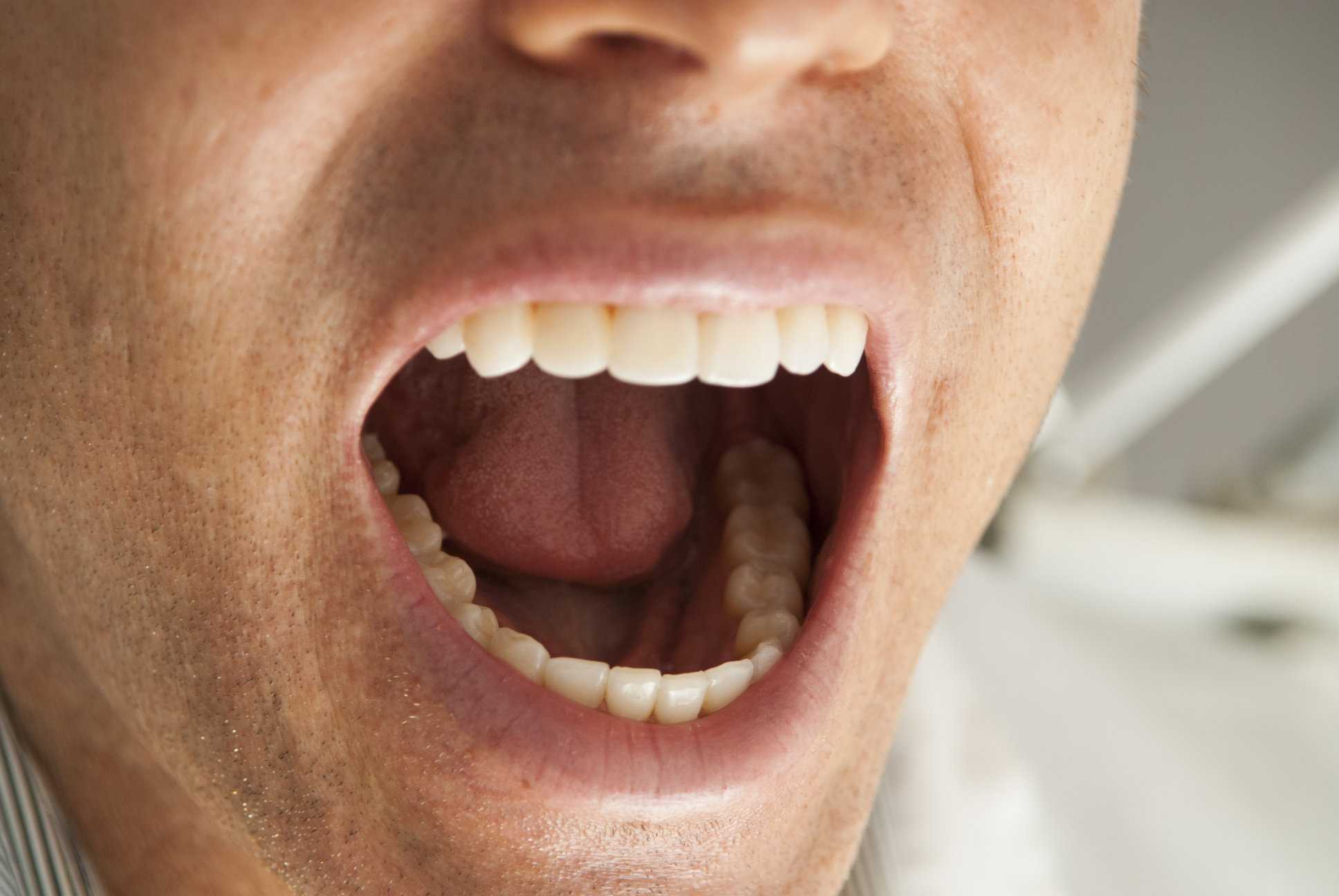 К чему снятся гнилые зубы у себя или другого человека: толкование по различным сонникам