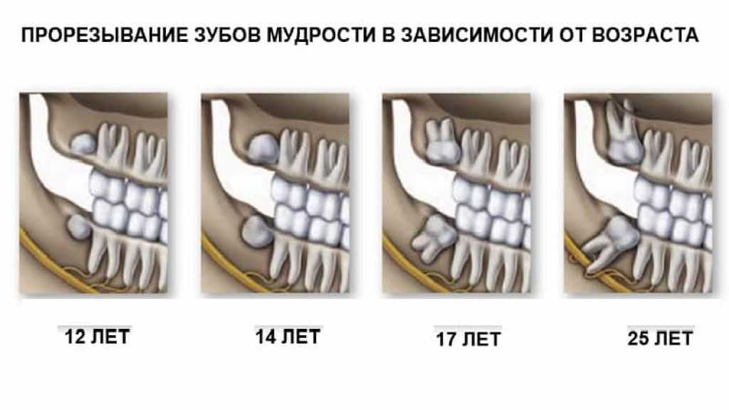 Откололся кусок зуба, сломался зуб, щель между передними зубами, щербинка – приметы