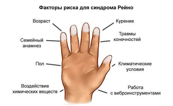 Приметы о пальцах: прищемить, уколоть, порезать
