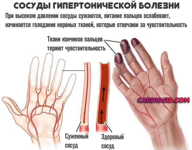 Порезать палец или ладонь на руке – досадная оплошность или предвестник? толкование приметы