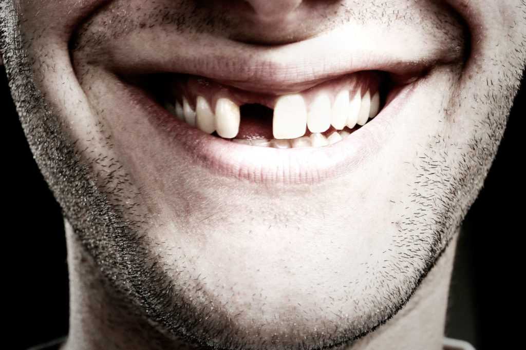 К чему снится вырвать зуб? толкование по 34 сонникам